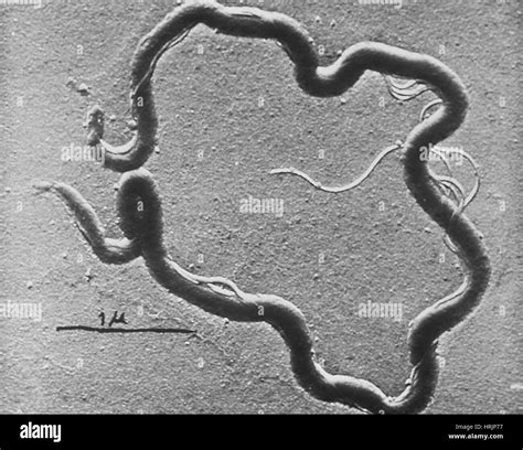 Treponema pallidum micrograph hi-res stock photography and images - Alamy