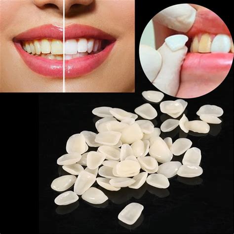 Dental Teeth Veneers Ultra Thin Whitening Resin Anterior Upper Temporary Crown Porcelain Dental ...