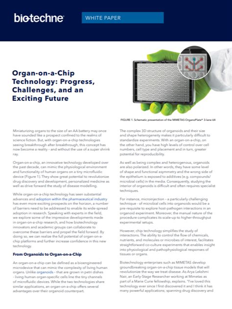 Organ-on-a-Chip Technology: Progress, Challenges, and an Exciting Future