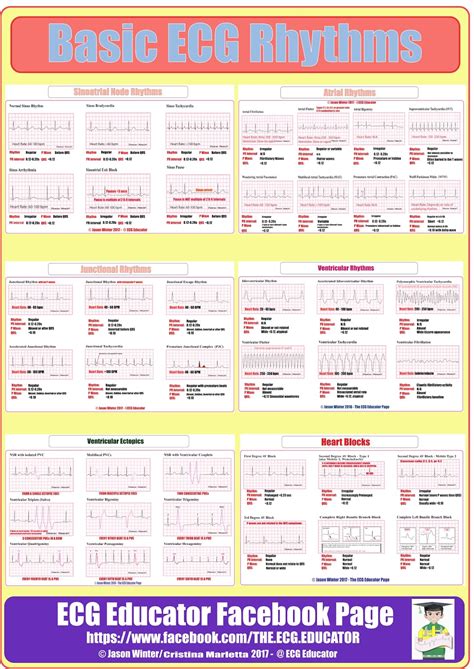 ECG Educator Blog : Basic ecg rhythm strips