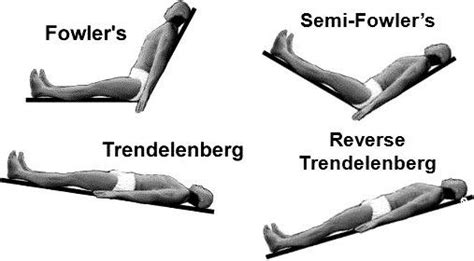 Trendelenburg Position Nursing