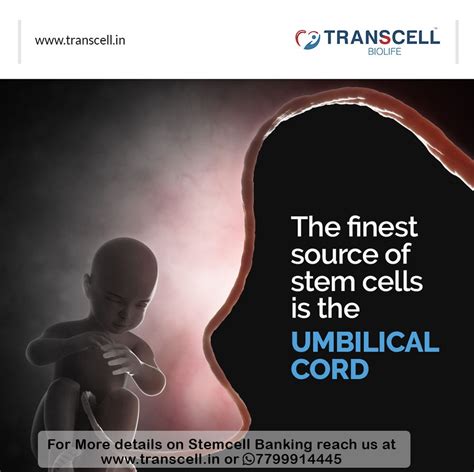 The finest source of stem cells is the UMBILICAL CORD - K Vikas - Medium