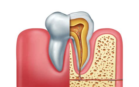 3 Symptoms Of Root Canal Infection That Shouldn’t Be Ignored