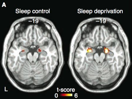 The Effects of Sleep Deprivation on the Brain | Serena's Weekly Psychology