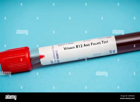 Vitamin B12 And Folate Test These Test measure the levels of these ...