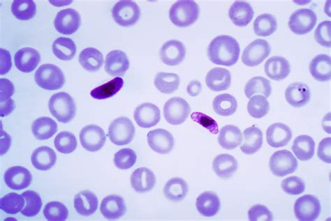 File:Plasmodium falciparum 01.png - Wikimedia Commons