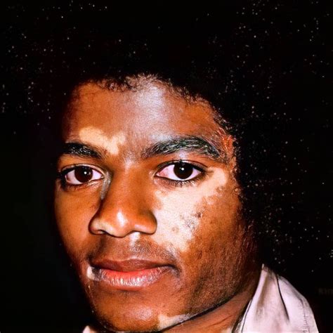 Michael Jackson Skin, Facts About Michael Jackson, Michael Jackson ...