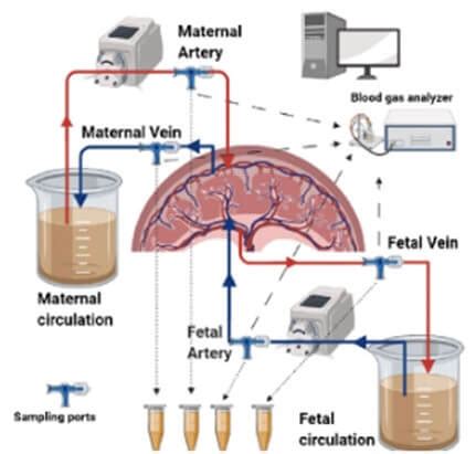 Complications and Outcomes - Maternal & Newborn