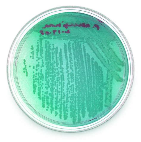 Tryptic Soy Agar (TSA): Composition, Preparation, Uses – Microbe Online