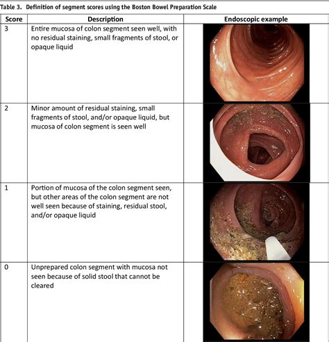 Update on Bowel Preparation for Colonoscopy | Semantic Scholar