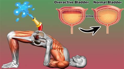 3 SIMPLE Exercises Work for Overactive Bladder | Kegel Exercises – WeightBlink