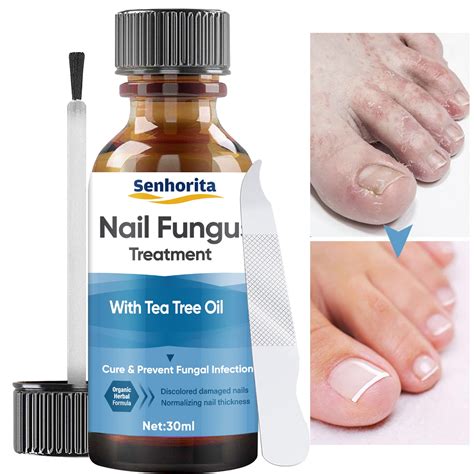 Toenail Fungus Treatment, Nail Fungus Treatment for Toenail Fungus ...