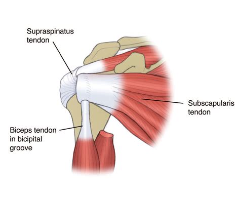 Subscapularis Shoulder Pain