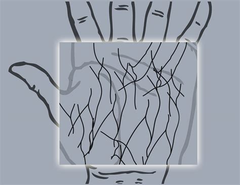 Iris recognition Biometrics Vs Palm Vein Biometrics