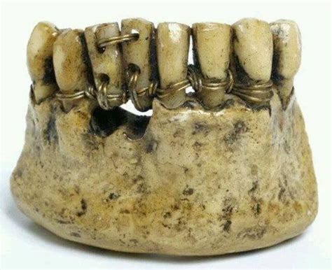 Ancient egyptian dentistry : r/pics