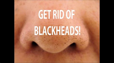 HOW TO GET RID OF BLACKHEADS! DIY BLACKHEAD TREATMENT! - YouTube