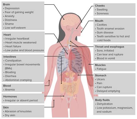 Bulimia Nervosa | Concise Medical Knowledge