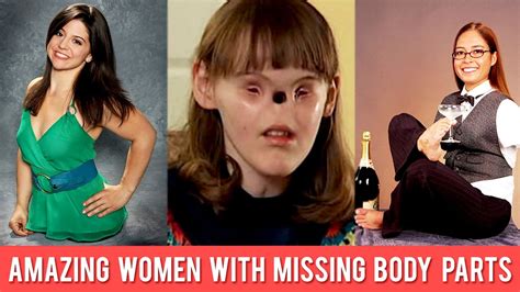 8 Amazing Women With Missing Body Parts - YouTube