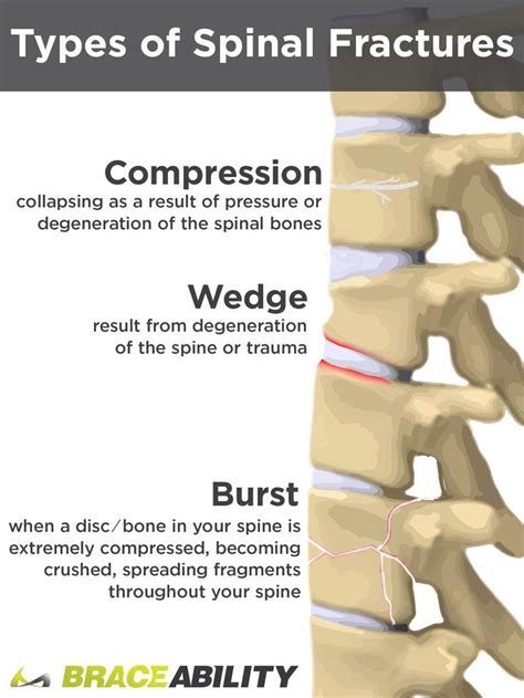 Pin on Back Exercises