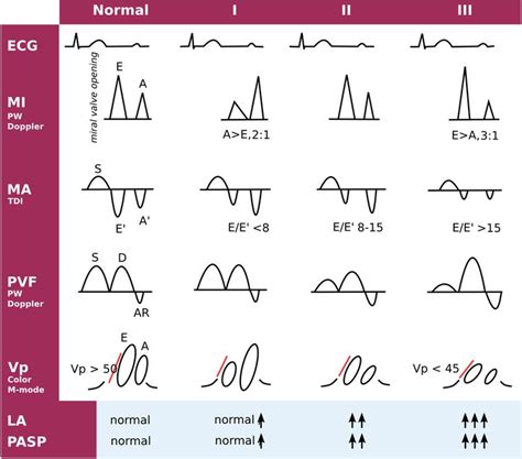 Diastole.svg | Cardiac sonography, Diagnostic medical sonography, Cardiology