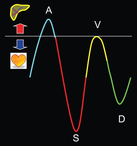 Understanding the Spectral Doppler Waveform of the Hepatic Veins in Health and Disease ...