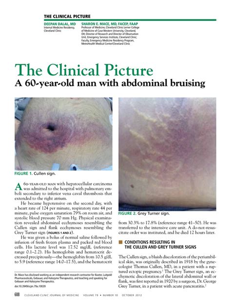 Abdominal Bruising