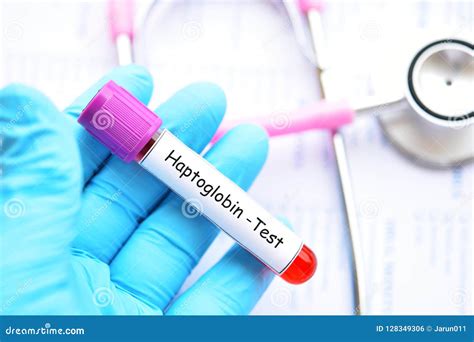 Blood Sample Tube for Haptoglobin Test Stock Photo - Image of hypochromia, analyzing: 128349306