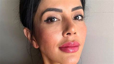 Jasmine Pineda is dissolving her lip filler -- Here's why