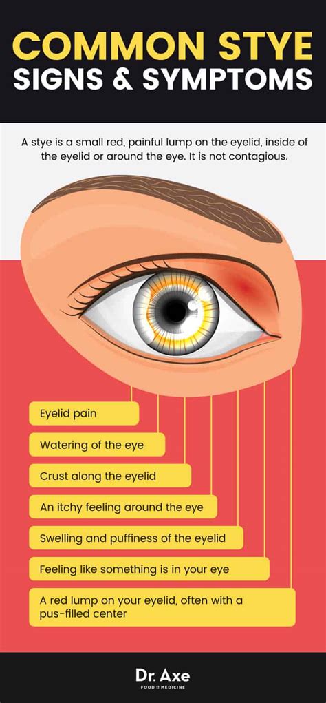 Stye Eye Diseases