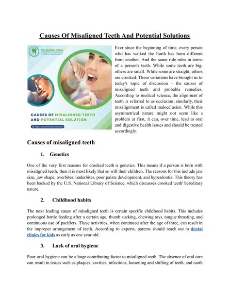 PPT - Causes of misaligned teeth and potential solution PowerPoint ...