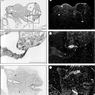 RET expression in the Wolffian duct. a,c,e: Photomicrographs of... | Download Scientific Diagram