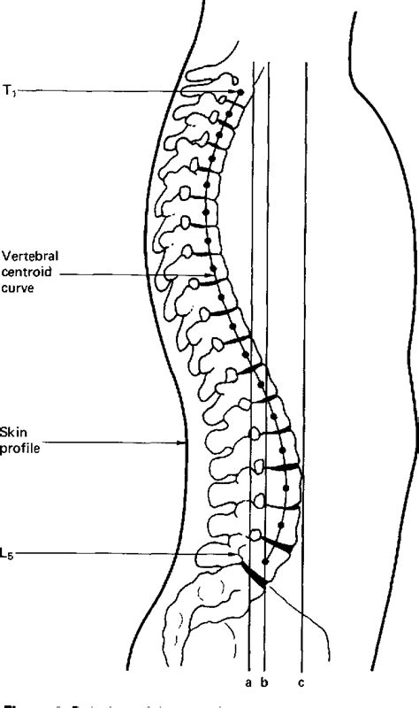 Figure 1 from Line of gravity relative to upright vertebral posture ...