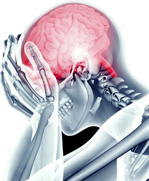 Migraine and Postdrome – Health By Principle