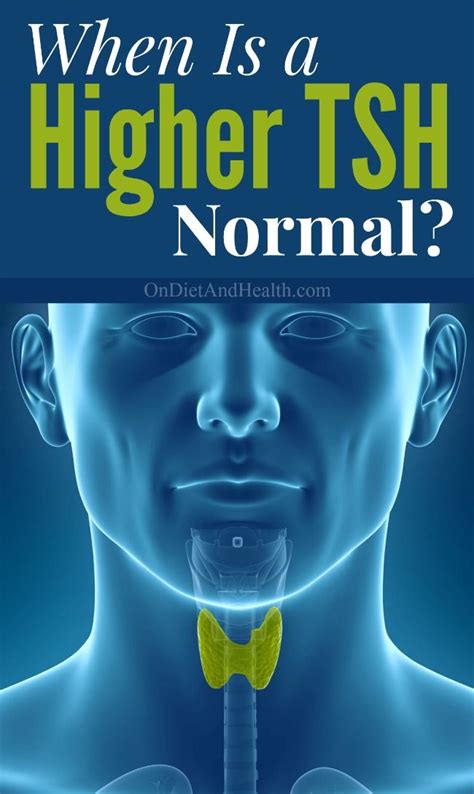 When Is High TSH Normal? | High tsh, Thyroid problems, Thyroid levels