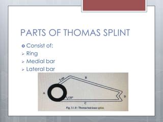 Splint and tractions | PPT