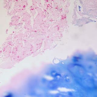 Pseudomembranous Tracheitis, Kinyoun Carbolfuchsin Acid-Fa… | Flickr