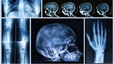 Radiography utilise medical radiation in the form of conventional X-ray ...