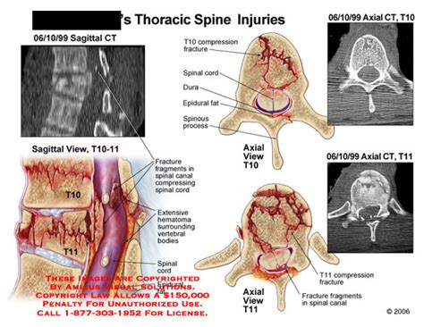 Medical Exhibits, Demonstrative Aids, Illustrations and Models