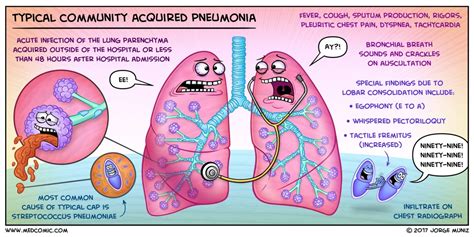 Learn typical community acquired pneumonia with a Medcomic