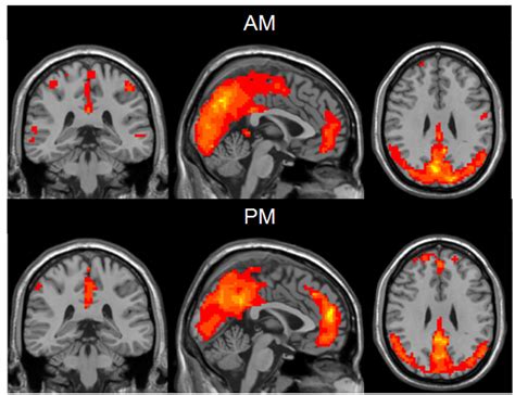 Frontiers | Diurnal Variations in Neural Activity of Healthy Human Brain Decoded with Resting ...