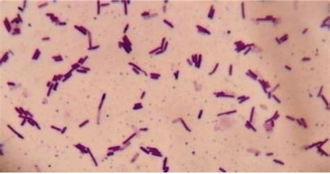 Vegetative form of Bacillus (rod shaped and thin) at 1000× ...