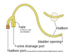 indwelling foley catheter