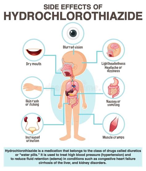 Human Anatomy Diagram Cartoon Style of Hydrochlorothiazide Side Effects ...