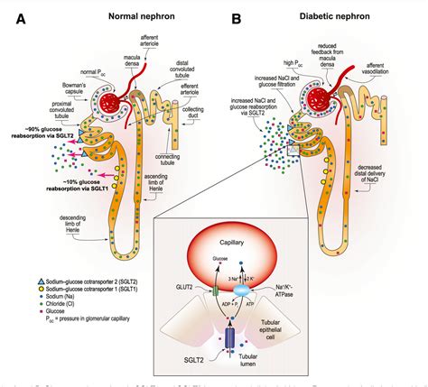 Figure 1 from Sodium–Glucose Cotransporter 2 Inhibition and Diabetic Kidney Disease | Semantic ...