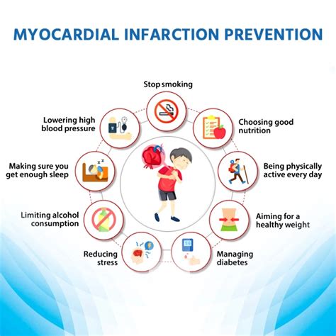 Myocardial Infarction Treatment Drugs