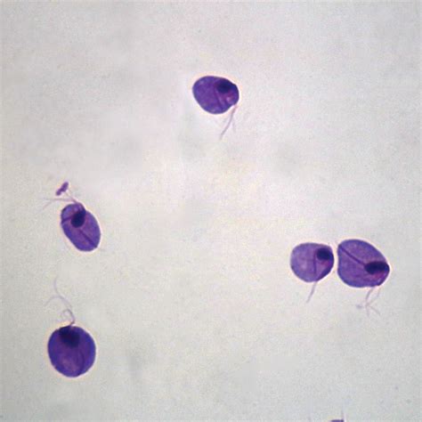 Trichomonas Vaginalis Microscope