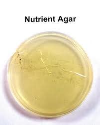 Nutrient Agar - Composition and bacteria cultured - Important Culture Media