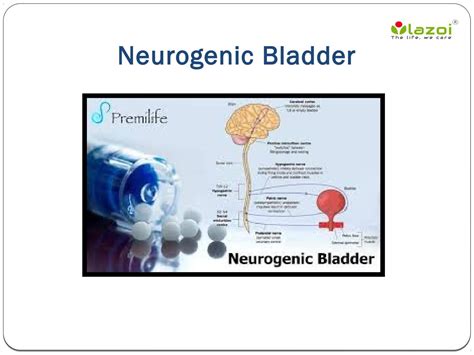 Neurogenic Bladder: Causes, Symptoms, Daignosis, Prevention and ...