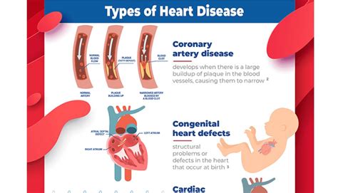 INFOGRAPHIC: TYPES AND CAUSES OF HEART DISEASE | Doctors Without Waiting Rooms