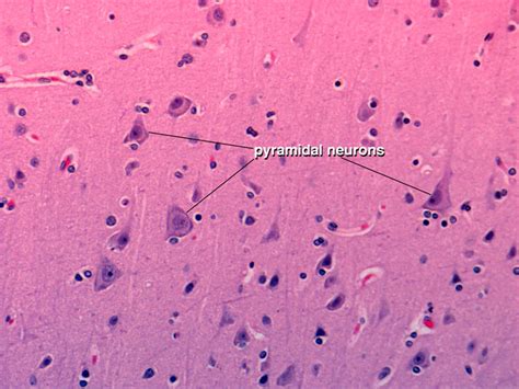 Chapter 1: Normal gross brain and microscopy | Renaissance School of ...